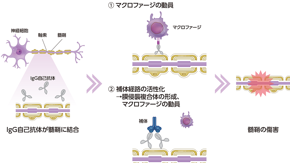 CIDPにおけるIgG自己抗体のはたらきの図