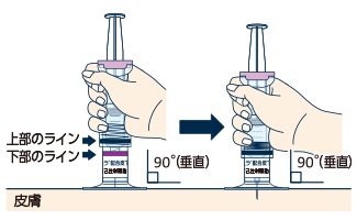自己注射補助具を握り、台座を皮膚に垂直に当て、ピッタリと密着させます。自己注射補助具の上部のラインと下部のラインが1本に重なり合う深さまで針を刺します。