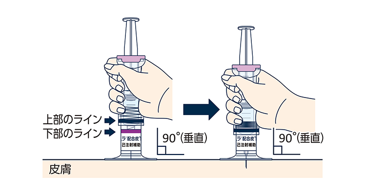 自己注射補助具を握り、台座を皮膚に垂直に当て、ピッタリと密着させます。自己注射補助具の上部のラインと下部のラインが1本に重なり合う深さまで針を刺します。