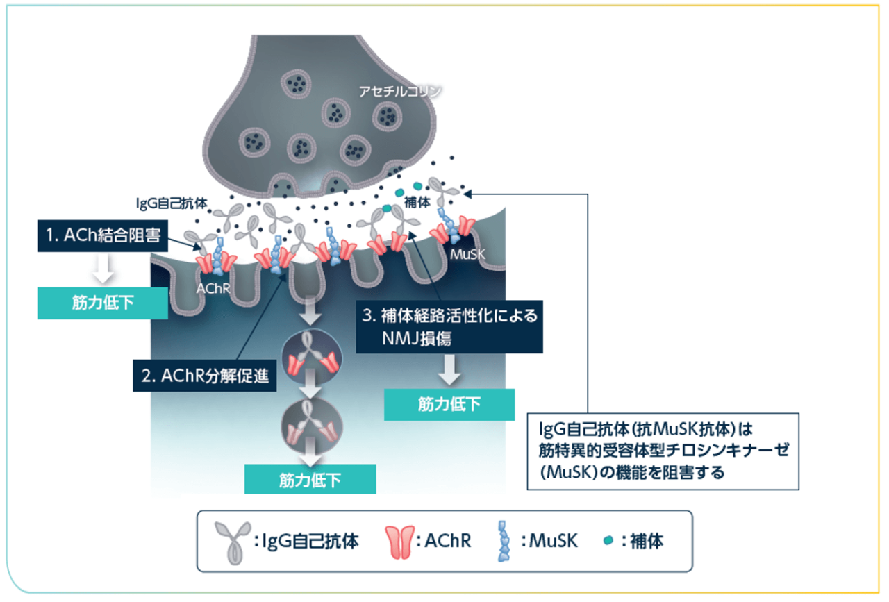 抗AChR抗体による3つの神経伝達障害のメカニズムの図
